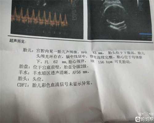 广州医院哪里可看性别：想做孕前检查挂哪个科