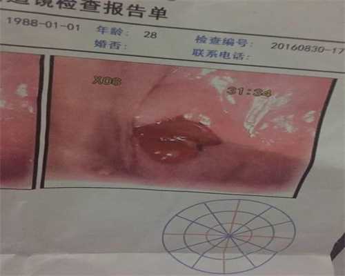 精英宝贝广州官网网址_胚胎移植后着床会痛吗